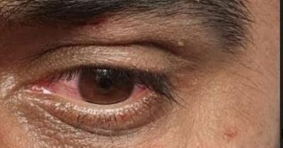 Taxi driver lured into dead end street and beaten with knuckle duster in vile racist attack