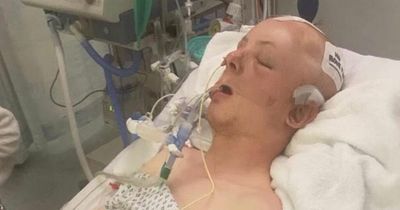 Heartbreak as Gateshead lad has part of skull removed after horrific motorcycle crash