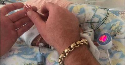 'Miracle' baby born so small her hands were the size of dad's fingernails