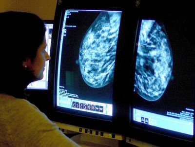 NHS cancer backlog could take five years to clear, experts warn