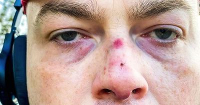 Young man with autism beaten up while out walking in Donegal