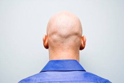 Calling man ‘bald’ is sexual harassment, employment tribunal rules
