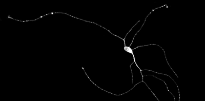 Lab-grown mini-brains could help find treatments for Alzheimer's and other diseases