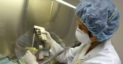 Scottish health chiefs confirm monkeypox contact tracing in Scotland after flight