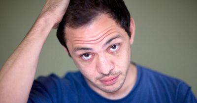 Calling men 'bald' is sexual harassment, tribunal rules