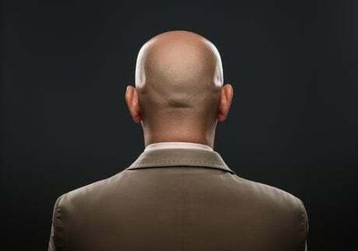 Calling man ‘bald’ can be sexual harassment, employment tribunal rules