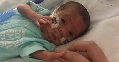 Brave mum has brought her little boy back to life THREE times after his premature birth