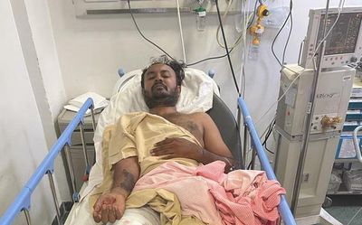 Bengaluru acid attacker shot at while allegedly trying to flee