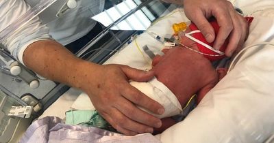 Miracle 3lb baby beats odds after spending weeks in hospital
