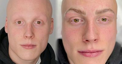 Student lost hair at 15 through GCSE stress - now he's got a new look after inspiration from mum