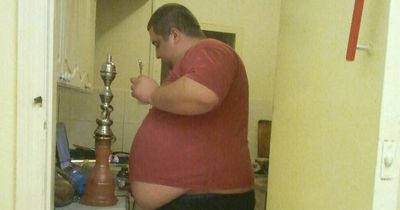 XXXXXL man who ate 10,000 calories a day sheds half his body weight after stairs incident