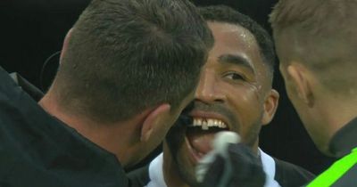 Callum Wilson suffers gruesome injury during Newcastle vs Arsenal