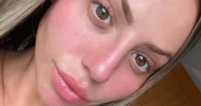 Geordie Shore's Holly Hagan unrecognisable after getting work done before wedding