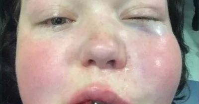 Lesbian couple allegedly attacked at bus stop in Dublin