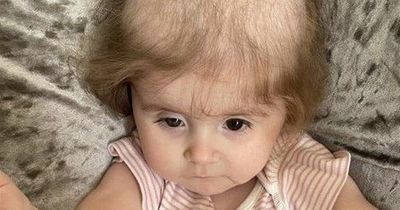 Girl with condition that makes her pull hair out is to get head shaved to raise funds for child with cancer