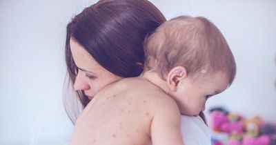 Children getting food poisoning as parents turn off fridges to save amid soaring bills