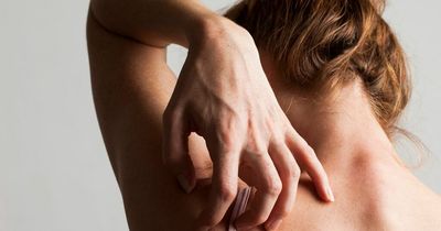 Parasite infection warning signs on your skin – and other symptoms