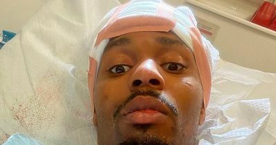 UFC star has near-death experience after 45-minute wait for help after crash