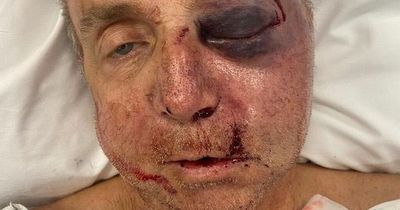 Man left disfigured by neighbour after being battered during garden dispute