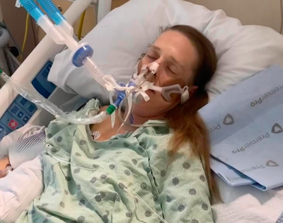 Woman put on life support after her dog head-butted her