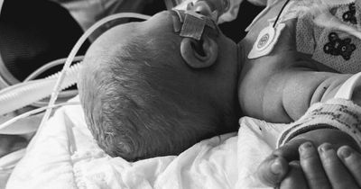 Northern Ireland parents on keeping son's legacy alive and paying tribute to health staff who helped family