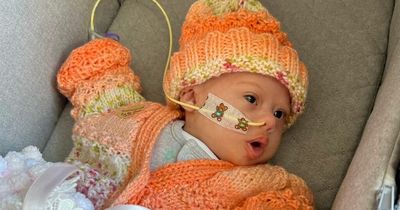 Newborn baby undergoes two open heart surgeries just days apart