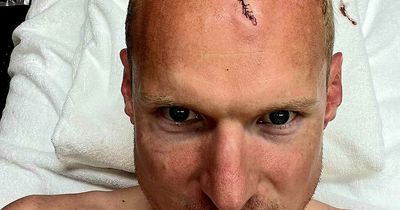 Frankfurt captain Sebastian Rode shows off Rangers battle scar after bloodied trophy lift
