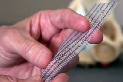 New fund opened for mesh implant patients in 'milestone' for women