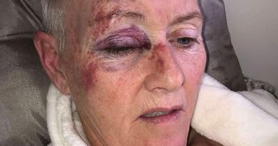 Thug who kicked East Kilbride gran unconscious at funeral wake ordered to pay fine