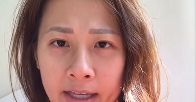 Australian woman who woke up with Irish accent after surgery shares update on year living with 'bizarre' condition