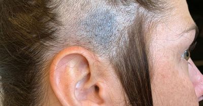 'I just thought my son had doodled on me - but my hairdresser saved my life'