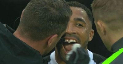 Callum Wilson breaks silence on losing tooth vs Arsenal and emergency dental work