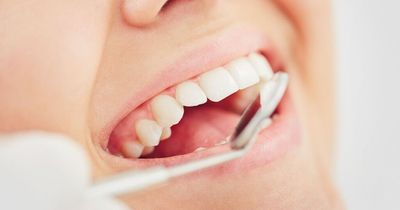 Five problems with teeth which can mean more serious health issues