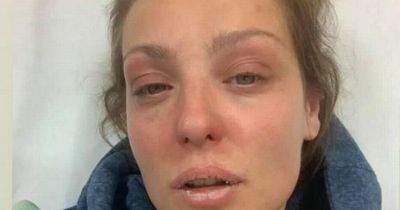 Strictly's Amy Dowden posts picture showing heartbreaking reality of living with health condition