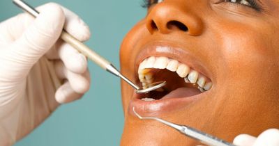 Cost of living: 9 reasons you can get free NHS dental treatment