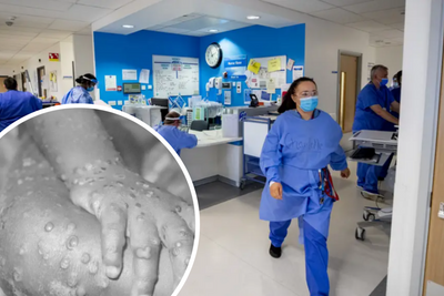 Monkeypox symptoms you should look out for as first Scottish case confirmed