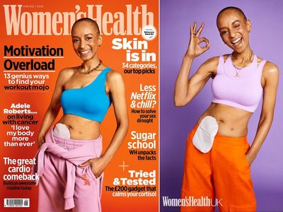 Radio 1 DJ Adele Roberts appears on cover of Women’s Health with stoma bag