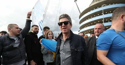 Noel Gallagher sporting two black eyes and stitches after 'headbutt' from Rúben Dias' dad