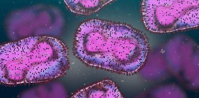 Monkeypox Q&A: how do you catch it and what are the risks? An expert explains