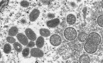 Tech & Science Daily: UK Monkeypox cases on the rise