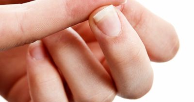 Type 2 diabetes symptom appearing on your nails - signs to spot and when to seek help