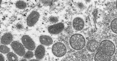 UK monkeypox cases rise to 57 as raves linked to spread in Europe