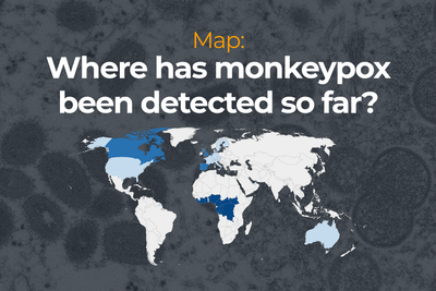 Map: Where has monkeypox been detected so far?