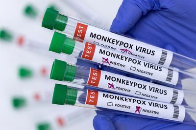 Czech Republic detects its first case of monkeypox