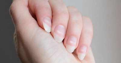 The diabetes signs in your nails - how to spot them and when to get help