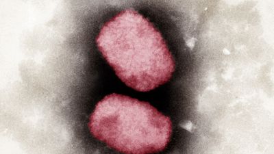 Push for targeted monkeypox vaccine rollout in France, Denmark