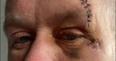 East Kilbride Thistle co-boss quits football as violent assault takes mental toll