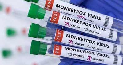 UK monkeypox cases rise to 78 as another seven are detected in England