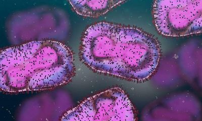 Monkeypox may have been circulating in UK for years, scientists say
