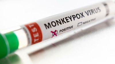 Roche Develops Test Kits to Detect Monkeypox Virus